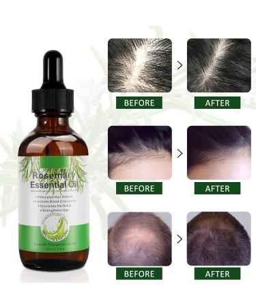 Rosemary Oil for Hair Growth (60ml) | 100% Pure Organic Rosemary Essential Oil to Stimulate Hair Growth Improve Hair Loss and Nourish Scalp | Promotes Hair Eyebrow & Eyelash Growth for Men & Women - Buy Online on GoSupps.com