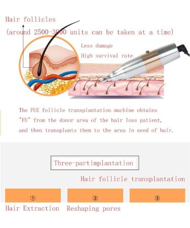 Hair Follicle Extractor Instrument - Adjustable 3-Speed Mode Scar-Free Solution for Hair Loss & Thinning Hair - International Shipping Available - Buy Online on GoSupps.com