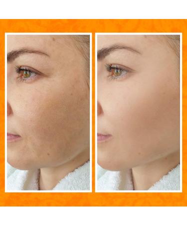 Buy BEE and YOU Anti Aging Face Cream Serum - Vitamin C Moisturizer & Skin Brightener with Bee Propolis | 1 fl oz - Shop Internationally - Buy Online on GoSupps.com