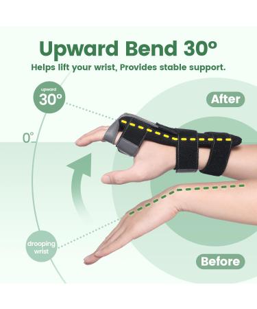 Radial Nerve Palsy Brace - Adjustable Splint for Finger Extension & Wrist Drop | Recovery Support for Crutch Palsy Stroke MCP Arthroplasty - Buy Online on GoSupps.com