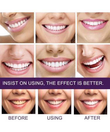 Purple Teeth Whitening Toothpaste - Effective Tooth Spot Removal & Color Correction Serum for Adults - 60g (1 Pack) | Brighten Your Smile - Buy Online on GoSupps.com