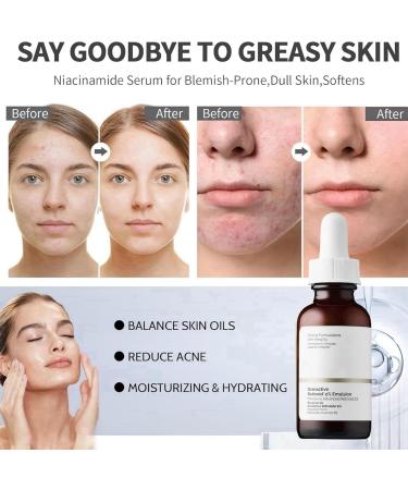 Retinoid 2% Emulsion Retinol Serum Retinol Serum High Strength for Face Anti-Aging Face Serum Face Moisturiser Retinol Face Serum Brightening Serum Anti Wrinkle Serum Fade Fine Lines Skin Repair Serum - Buy Online on GoSupps.com