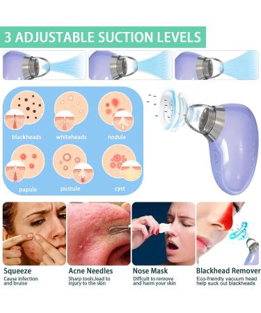 Pore Vacuum with Camera for Blackhead Removal - Real-Time Pore Minimizer and Acne Treatment Tool (Purple) - Buy Online on GoSupps.com