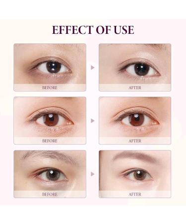  Orgrul 1 x eyelift serum 15g Mango Revitalizing Eye Cream Hyaluronic Acid Repair Cream Dark Circles Repair Bag Eye Repair Cream - Buy Online on GoSupps.com