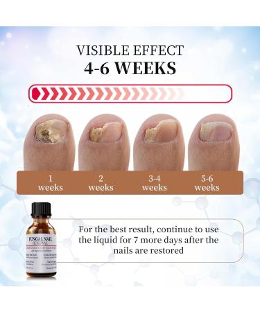 Extra Strength Toenail Fungus Treatment - Fast Acting Nail Repair Liquid for Discolored Nails with Nail File - Buy Online on GoSupps.com
