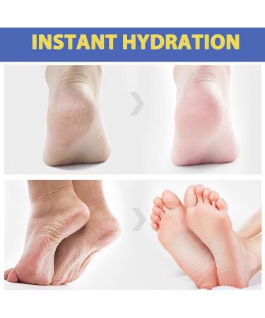 tysumeoy Foot cream with 60 urea for very dry skin - Buy Online on GoSupps.com