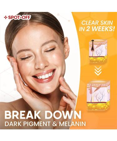 Spot Off Freckle Whitening & Dark Spot Corrector Cream - Acne Scar & Melasma Removal Treatment for Face (2 Pcs) - Buy Online on GoSupps.com