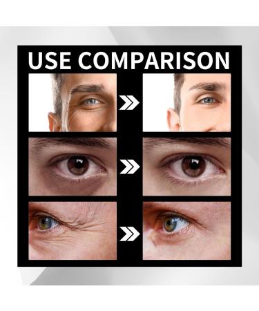 Dark Circles Roller 027oz Eye Roller Serums antipuff and firming eye roller Natural stimulating eye serums for puffy eyes dark circles and fine lines Pologmase - Buy Online on GoSupps.com