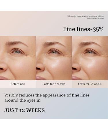 Shichangda Eye Cream Stick | Wrinkles Collagens Moisture Balm | Collagens Multi Balm Stick | Anti-Aging Reduce Under The Eyes Puffiness | Boosts Radiance & Elasticity - Buy Online on GoSupps.com