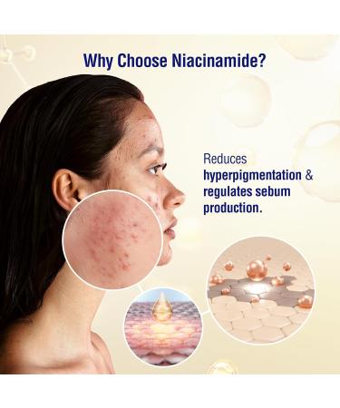 Derm'Doc 10% Niacinamide Face Serum 30ml | All Skin Types | Controls Sebum Production | Minimizes Pores | Helps Reduce Hyperpigmentation & Age Spots | Improves Skin Texture | Hydrates and Moisturizes - Buy Online on GoSupps.com