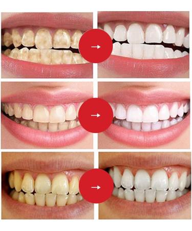 Daffezon Probiotic Toothpaste SP-7 Sopami Probiotic Toothpaste SP-7 Probiotic Stain Removal Toothpaste SP-7 Deep Cleaning Toothpaste - Buy Online on GoSupps.com