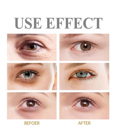 60-Second Age-Defying Eye Gel | Instant Firming Eye Cream & Puffiness Remover | Anti-Wrinkle Eye Serum for Youthful Skin - Buy Online on GoSupps.com