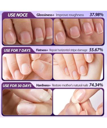Stylo Repousse Cuticules L'huile Stylo 2 En 1 Pour Dissolvant De Cuticules Et Huile Pour Ongles Huile Cuticules Ongles Stylo Pour Soin De Manucure Des Renforcement Et R par (1) - Buy Online on GoSupps.com