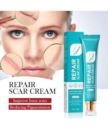 Crsetmyth Firming & Repair Repair Cream 2 pieces repair cream scar care gel for surgical loose scars suitable for new and old scars stretch marks surgical scars - Buy Online on GoSupps.com