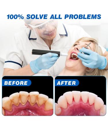 HassoKon Teeth Cleaning Kit - 4 Adjustable Modes, 4 Heads, IPX6 Waterproof (Black) - Buy Online on GoSupps.com