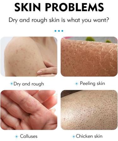 Moisturizing cream for dry feet - 100g moisturizing repair cream | Cream for calluses and dry skin on the feet to quickly soften hard skin and prevent recurring dryness - Buy Online on GoSupps.com