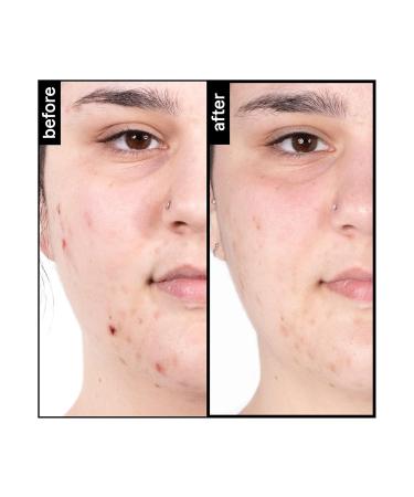 Moisture Treatment | Deep Hydration for Healthy Skin | International Shipping Available - Buy Online on GoSupps.com