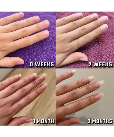 Stylo huile de croissance des ongles applicateur for huile de cuticules huile de croissance des ongles huile for la croissance et la force claircit le soin des ongles (Color : 5pcs) - Buy Online on GoSupps.com