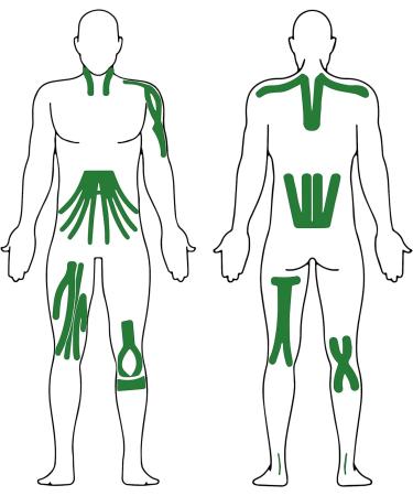 Effekt Kinesiology Tape Waterproof - 5m x 5cm Roll for Muscle Support & Recovery - Green - Buy Online on GoSupps.com