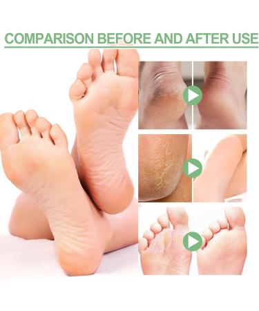 Trendyfave Foot Care Cream Foot Cream For Cracked Heels And Dry Skin Cracked Heel Repair Cream With Vitamin C And Aloe Vera For Deep Moisturizing Callus Remover And Soften Skin Care Hands & Feet - Buy Online on GoSupps.com