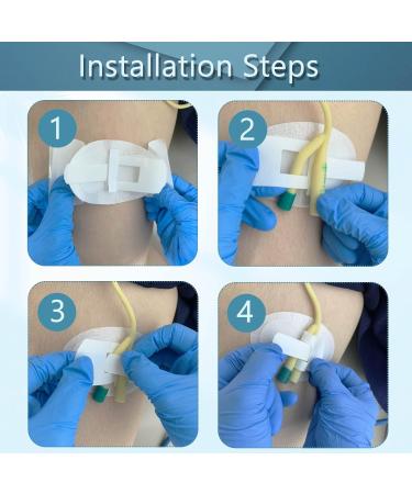 Catheter Leg Band Fixation Sticker - Urethra Holder Adhesive Pad for Incontinence | 3-Piece Drainage Stabilization Device - Buy Online on GoSupps.com