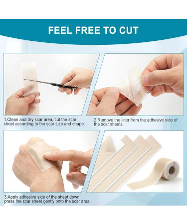 Henda Silicone Scar Sheets 1.6x120 Tape Roll - Professional Removal for C-Section, Burn, Acne, Keloid - Reusable & Softens Scars - Buy Online on GoSupps.com