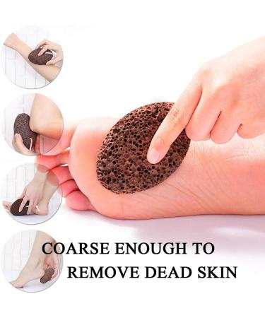 PHOGARY Natural Pumice Stone for Feet and Hands Hard Skin 1 Pack Volcanic Lava Large Foot Stone Pedicure Tools Callus Remover for Dead Skin Black Natural Foot File Exfoliation Foot Scrubber Rock Black - Buy Online on GoSupps.com