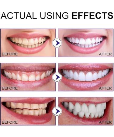 Probiotic Teeth Whitening Powder - Mint Formula for Deep Clean & Fresh Breath | International Shipping Available - Buy Online on GoSupps.com