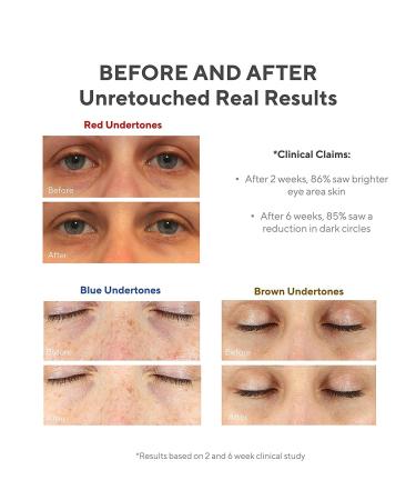 Murad Vita-C Eyes Dark Circle Corrector 0.5 Fl Oz - Vitamin C Brightening Serum for Puffiness & Wrinkles - Buy Online on GoSupps.com