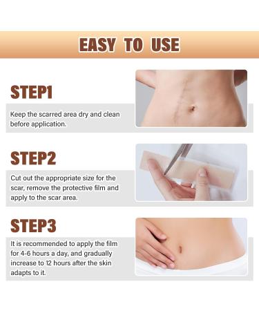 Buy Silicone Scar Sheets & Tape for Effective Scar Removal Surgical C-Section Tummy Tuck Keloid Treatment (1.6 x 59 Roll - Buy Online on GoSupps.com