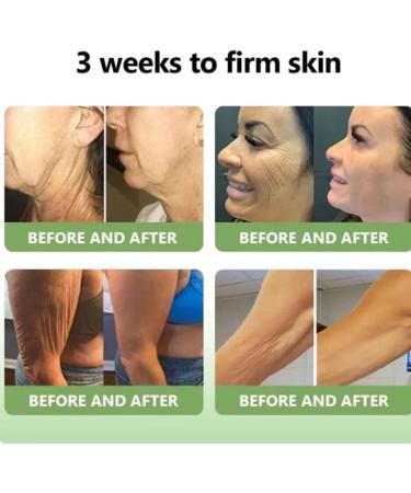 Furzero Luxurious Firming Collagen Cream Stdei Luxurious Firming Collagen Cream Collagen Anti-Wrinkle Cream Moisturizing Face and Body Care Cream - Buy Online on GoSupps.com