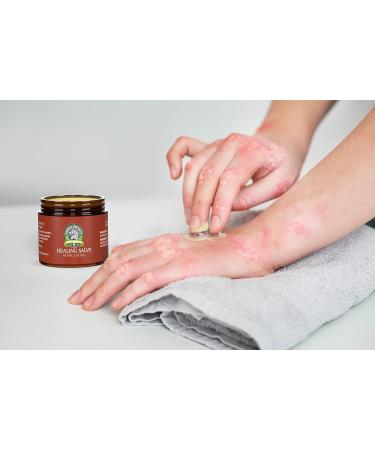 Sandalwood's Organics Healing Salve - Natural Calendula Ointment for Baby | Diaper Rash, Minor Burn, Chafing Relief | Moisturizing Balm with Marigold, Lavender, Coconut Oil, Beeswax - Yellow - Buy Online on GoSupps.com