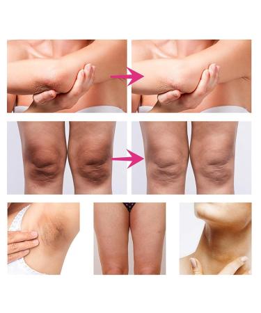 BEROZA Cremas de manchas corporales Vitamin C Body Moisturizer Cream Para Piel Entrepierna Manchas Codos Piernas Zonas ntimas Cara Axilas Rodillas Cuello 50G - Buy Online on GoSupps.com