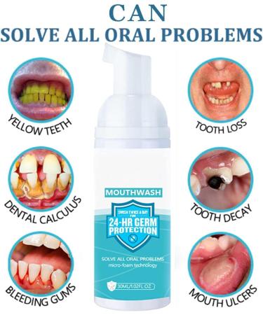 Vesone Foam Toothpaste Whitening Toothpaste Foam Deep Cleaning Gums Stain Removal Oral Care Natural Mouthwash Toothpaste Replacement - Buy Online on GoSupps.com