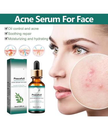 Acne Scar Fading Serum Pore Minimizing Hydrating Essence - Brightens & Repairs Skin Makes Skin Smooth Easy To Use(2PCS) - Buy Online on GoSupps.com