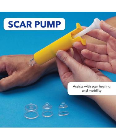Rolyan Scar Pump: Suction Pump for Lesion Healing, Tendon Repair, and Scar Mobility - Includes Various Suction Cup Sizes - Buy Online on GoSupps.com