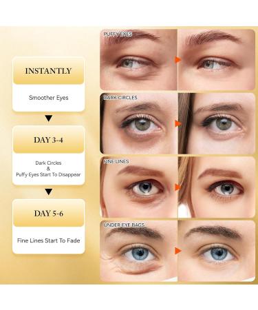 24K Gold Under Eye Patches - 60 Pcs Anti-Aging & Hydrating Gel Masks for Dark Circles Puffiness & Wrinkles Treatment - Buy Online on GoSupps.com
