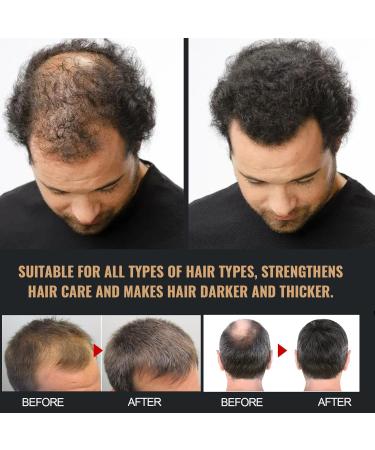 Tindedly Root Activating Shampoo Hair Regrowth Shampoo Shampoo For Gray Hair Shampoo For White Hair Natural Formula For Thicker Hair(3pcs) - Buy Online on GoSupps.com