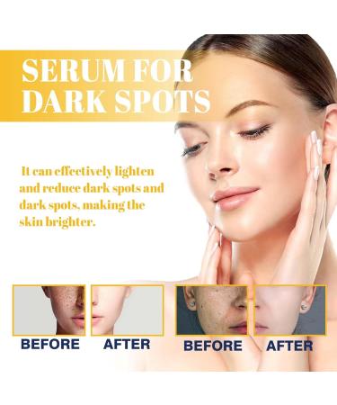  JINGLING JINGLING Skin Brightening Treatment - 30 ml - Firming and Brightening Treatment - Natural Facial Care - For morning day night travel spa home winter and - Buy Online on GoSupps.com