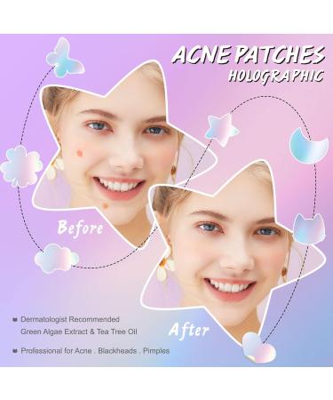 KLLALO Acne Pimple Master Patch Intensive 84 Pieces Button Patch Acne Patch Spot Effective Treatment with Hypoallergenic Tea Tree Oil Laser 84 pieces - Buy Online on GoSupps.com
