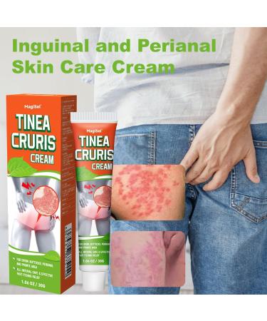 RedOceansM Intimate zone Relieves cream care cream for sensitive skin in the groin itching intimate care cream in the groin ringworms eczema soothes and cools skin irritations 30 g - Buy Online on GoSupps.com