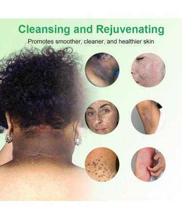 Purifying Exfoliating Gel Professional Purifying Exfoliating Gel Advanced Exfoliating Gel Exfoliating Gel for Face and Body Exfoliating Gel for All Skin Types Deep Cleansing (1 Pack) - Buy Online on GoSupps.com