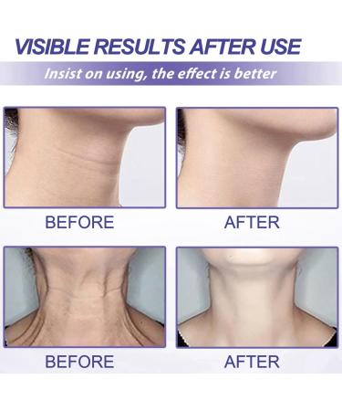 Tighten&Lift Neck Cream Neck Firming Cream Anti-Aging Neck Cream for Tightening and Wrinkles Anti Wrinkle Moisturizing Neck Cream Neck Tightening Creams That Work Smoothing Double Chin Neck Cream - Buy Online on GoSupps.com