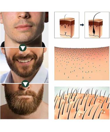  Stronrive Hair Growth Oil Hair Growth Strengthening Oil Hair Growth Oil Natural Growth Care Oil Nourishing Care for Stronrive Ends - Buy Online on GoSupps.com