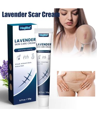 RedOceansM Scar gel scar removal cream scar care gel scar repair cream stretch mark creams remover 20 g scar ointment after use natural scar gel reduces the visibility of - Buy Online on GoSupps.com