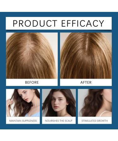 Hair oil Oil for Hair Growth 30ml Natural Liquid RollOn for Repairing Hydration Prevents Shedding Shedding Improves Thickness Volume - Buy Online on GoSupps.com