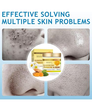 Kojic Acid and Turmeric Cleansing Pads 70 Pads Turmeric Kojic Acid Pads Facial Cleansing and Exfoliation for All Skin Types - for Men and Women 1 count (Pack of 1) - Buy Online on GoSupps.com