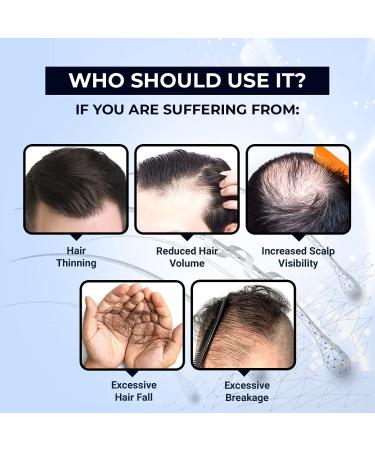 The Man Company Hair Growth Tonic 3.4 Fl Oz | 3% Redensyl & Jojoba Oil | Thickening & Nourishing Hair Loss Solution - Buy Online on GoSupps.com