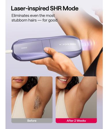 Ulike Air 10 IPL Laser Hair Removal Device for Women and Men - Virtually Painless with Sapphire Ice-Cooling Technology - SkinSensor, 4 Modes for Body & Face - Long-Lasting Results - At-Home Use - Buy Online on GoSupps.com