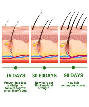 VOLLUCK Rosemary Hair Growth Serum - Nourishing Scalp Oil for Frizzy & Damaged Hair - Buy Online on GoSupps.com
